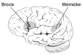 Historique de la dyslexie historique de la dyslexie broca wernicke